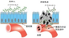 上新了 | 青滨附院开展肿瘤早筛新项目—异常糖链蛋白（TAP）检测